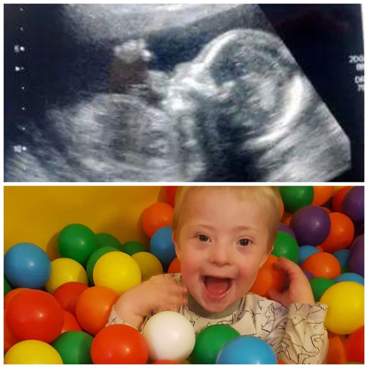 Still You – My Mencap Journalism Awards winning entry 